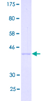 12.5% SDS-PAGE Stained with Coomassie Blue